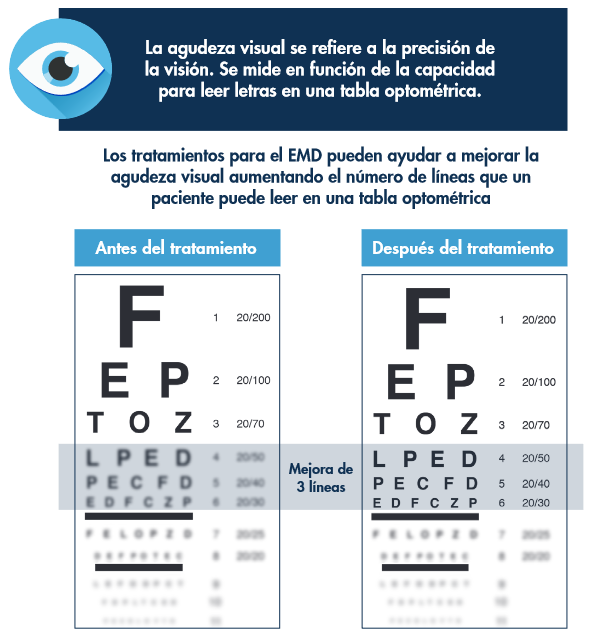 Ventajas del tratamiento con Ozurdex